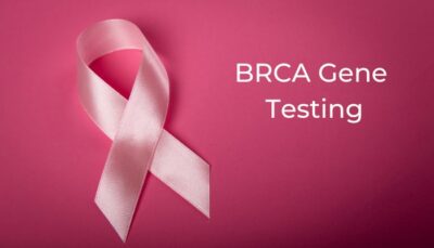 BRCA Testing