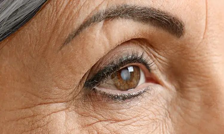 Warning Signs of Acute Congestive Glaucoma